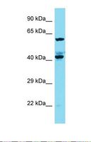 KIAA1841 Antibody - Western blot of Human A549. KIAA1841 antibody dilution 1.0 ug/ml.  This image was taken for the unconjugated form of this product. Other forms have not been tested.