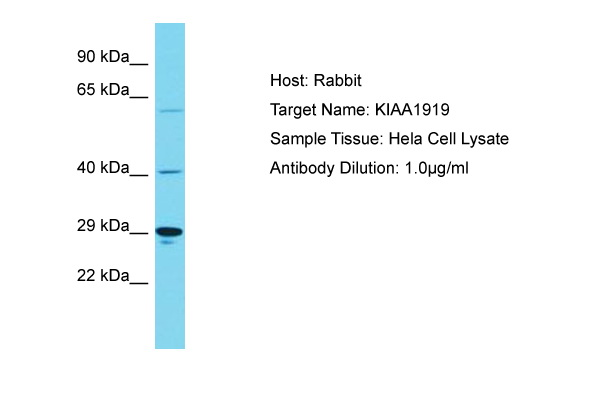 KIAA1919 / NAGLT1 Antibody -  This image was taken for the unconjugated form of this product. Other forms have not been tested.
