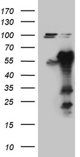KIAA1970 / EARS2 Antibody - HEK293T cells were transfected with the pCMV6-ENTRY control. (Left lane) or pCMV6-ENTRY EARS2. (Right lane) cDNA for 48 hrs and lysed