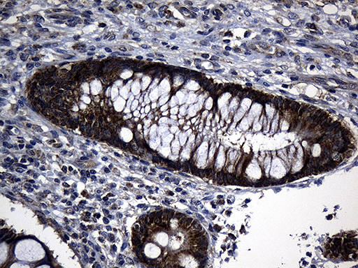 KIAA1970 / EARS2 Antibody - Immunohistochemical staining of paraffin-embedded Human colon tissue within the normal limits using anti-EARS2 mouse monoclonal antibody. (Heat-induced epitope retrieval by 1mM EDTA in 10mM Tris buffer. (pH8.5) at 120°C for 3 min. (1:500)
