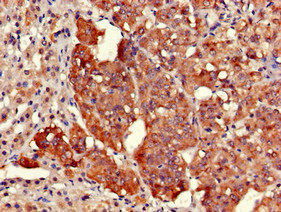 KIAA1970 / EARS2 Antibody - Immunohistochemistry of paraffin-embedded human adrenal gland tissue at dilution of 1:100