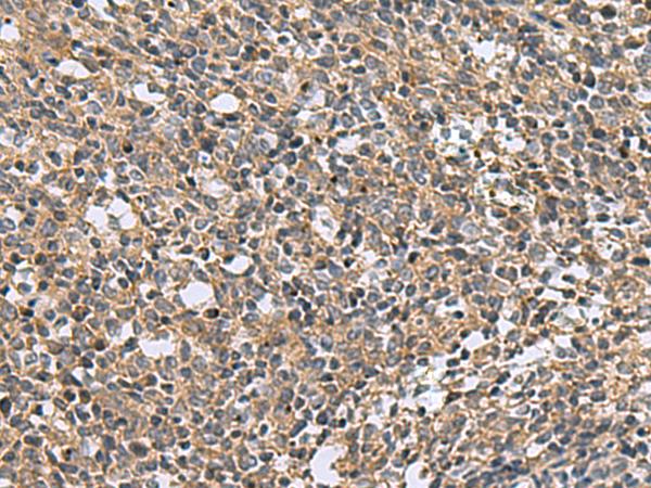 KIAA1970 / EARS2 Antibody - Immunohistochemistry of paraffin-embedded Human tonsil tissue  using EARS2 Polyclonal Antibody at dilution of 1:30(×200)