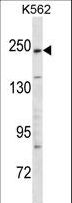KIDINS220 / ARMS Antibody - KIDINS220 Antibody western blot of K562 cell line lysates (35 ug/lane). The KIDINS220 antibody detected the KIDINS220 protein (arrow).