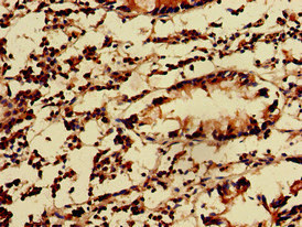 KIDINS220 / ARMS Antibody - Immunohistochemistry of paraffin-embedded human appendix tissue at dilution of 1:100