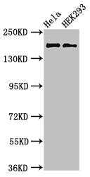 KIDINS220 / ARMS Antibody - Western Blot Positive WB detected in:Hela whole cell lysate,HEK293 whole cell lysate All Lanes:KIDINS220 antibody at 3µg/ml Secondary Goat polyclonal to rabbit IgG at 1/50000 dilution Predicted band size: 197,186,116,195,60 KDa Observed band size: 197 KDa