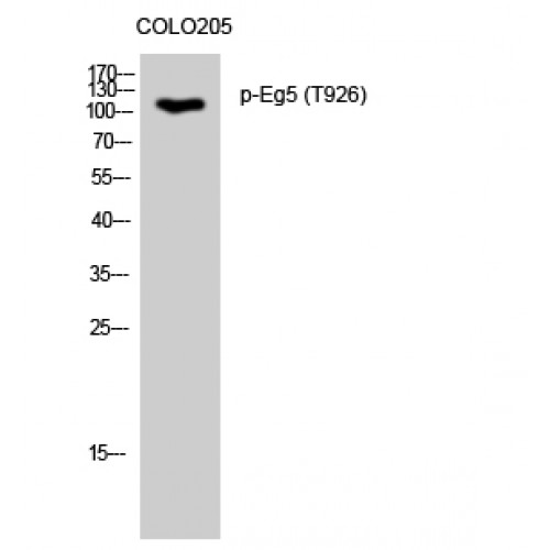 KIF11 / EG5 Antibody - Western blot of Phospho-Eg5 (T926) antibody