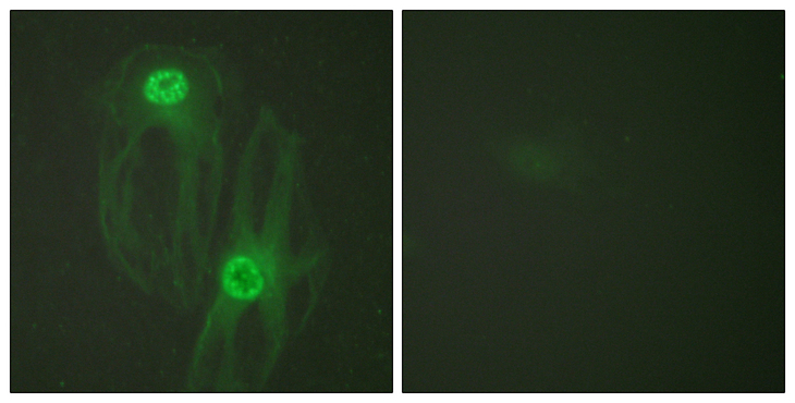 KIF11 / EG5 Antibody - Immunofluorescence analysis of HeLa cells, using KIF11/Eg5 Antibody. The picture on the right is blocked with the synthesized peptide.