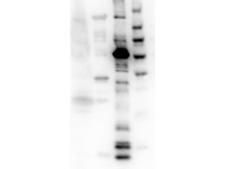 KIF11 / EG5 Antibody - Western Blot of Rabbit Anti-Eg-5 antibody. Lane 1: E.coli cell lysate expressing histidine tagged protein. Lane 2: Mouse brain lysate. Lane 3: Recombinant truncated Eg-5. Lane 4: MW. Load: 35 µg per lane for cell lysate. 50 ng of recombinant protein. Primary antibody: Eg-5 antibody at 1:1000 for overnight at 4°C. Secondary antibody: HRP rabbit secondary antibody at 1:40,000 for 60 min at RT.