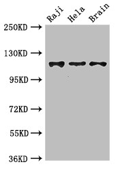 KIF11 / EG5 Antibody - Positive WB detected in:Raji whole cell lysate,Hela whole cell lysate,Mouse brain tissue;All lanes:KIF11 antibody at 3.5?g/ml;Secondary;Goat polyclonal to rabbit IgG at 1/50000 dilution;Predicted band size: 120 KDa;Observed band size: 120 KDa;