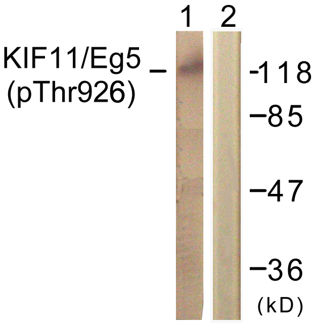 KIF11 / EG5 Antibody - Western blot analysis of lysates from COLO205 cells, using KIF11/Eg5 (Phospho-Thr926) Antibody. The lane on the right is blocked with the phospho peptide.