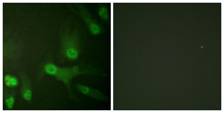 KIF11 / EG5 Antibody - P-peptide - + Immunofluorescence analysis of HeLa cells, using KIF11/Eg5 (Phospho-Thr926) antibody.