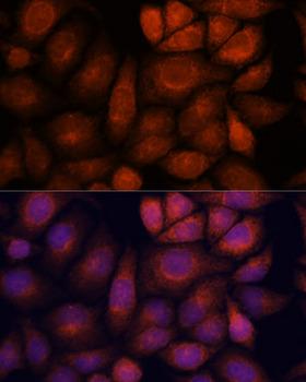 KIF13A Antibody - Immunofluorescence analysis of HeLa cells using KIF13A Polyclonal Antibody at dilution of 1:100.Blue: DAPI for nuclear staining.