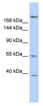 KIF13B / GAKIN Antibody - Western blot of HepG2 cell lysate.  This image was taken for the unconjugated form of this product. Other forms have not been tested.
