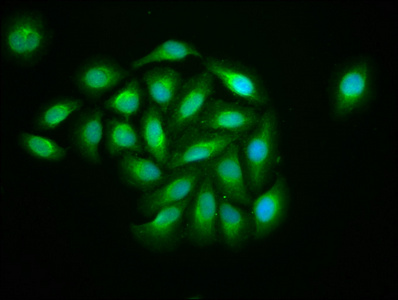 KIF13B / GAKIN Antibody - Immunofluorescence staining of A549 cells at a dilution of 1:133, counter-stained with DAPI. The cells were fixed in 4% formaldehyde, permeabilized using 0.2% Triton X-100 and blocked in 10% normal Goat Serum. The cells were then incubated with the antibody overnight at 4 °C.The secondary antibody was Alexa Fluor 488-congugated AffiniPure Goat Anti-Rabbit IgG (H+L) .