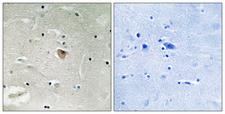 KIF13B / GAKIN Antibody - Peptide - + Immunohistochemistry analysis of paraffin-embedded human brain tissue using KIF13B antibody.