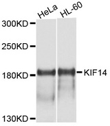 KIF14 Antibody - Western blot analysis of extracts of various cell lines, using KIF14 antibody at 1:1000 dilution. The secondary antibody used was an HRP Goat Anti-Rabbit IgG (H+L) at 1:10000 dilution. Lysates were loaded 25ug per lane and 3% nonfat dry milk in TBST was used for blocking. An ECL Kit was used for detection and the exposure time was 15s.