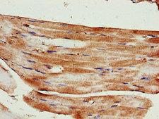 KIF14 Antibody - Immunohistochemistry of paraffin-embedded human skeletal muscle tissue using KIF14 Antibody at dilution of 1:100