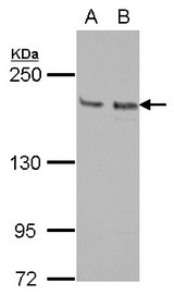KIF14 Antibody - Sample (30 ug of whole cell lysate) A: Jurkat B: Raji 5% SDS PAGE KIF14 antibody diluted at 1:1000
