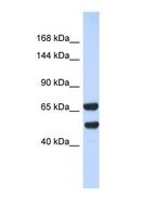 KIF16B Antibody - Western blot of Human 293T. KIF16B antibody dilution 1.0 ug/ml.  This image was taken for the unconjugated form of this product. Other forms have not been tested.
