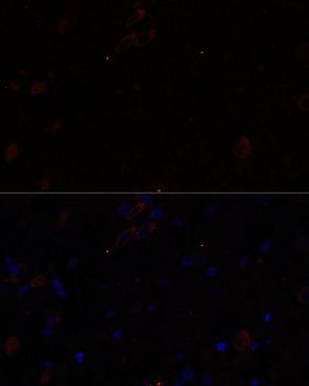 KIF17 Antibody - Immunofluorescence analysis of Rat brain using KIF17 Polyclonal Antibody at dilution of 1:100.Blue: DAPI for nuclear staining.