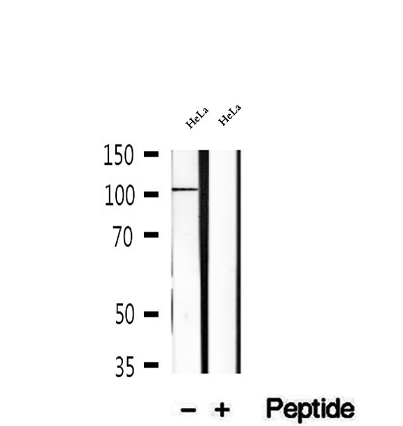 KIF18A Antibody - Western blot analysis of extracts of HeLa cells using KIF18A antibody.