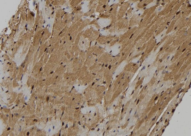 KIF18A Antibody - 1:100 staining mouse heart tissue by IHC-P. The sample was formaldehyde fixed and a heat mediated antigen retrieval step in citrate buffer was performed. The sample was then blocked and incubated with the antibody for 1.5 hours at 22°C. An HRP conjugated goat anti-rabbit antibody was used as the secondary.