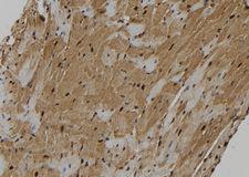 KIF18A Antibody - 1:100 staining mouse heart tissue by IHC-P. The sample was formaldehyde fixed and a heat mediated antigen retrieval step in citrate buffer was performed. The sample was then blocked and incubated with the antibody for 1.5 hours at 22°C. An HRP conjugated goat anti-rabbit antibody was used as the secondary.