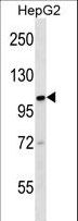 KIF18A Antibody - KIF18A Antibody western blot of HepG2 cell line lysates (35 ug/lane). The KIF18A antibody detected the KIF18A protein (arrow).