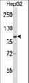 KIF18A Antibody - KIF18A Antibody western blot of HepG2 cell line lysates (35 ug/lane). The KIF18A antibody detected the KIF18A protein (arrow).