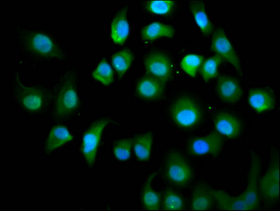 KIF18A Antibody - Immunofluorescence staining of A549 cells diluted at 1:100, counter-stained with DAPI. The cells were fixed in 4% formaldehyde, permeabilized using 0.2% Triton X-100 and blocked in 10% normal Goat Serum. The cells were then incubated with the antibody overnight at 4°C.The Secondary antibody was Alexa Fluor 488-congugated AffiniPure Goat Anti-Rabbit IgG (H+L).