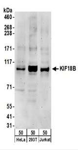 KIF18B Antibody - Detection of Human KIF18B by Western Blot. Samples: Whole cell lysate (50 ug) from HeLa, 293T, and Jurkat cells. Antibodies: Affinity purified rabbit anti-KIF18B antibody used for WB at 0.1 ug/ml. Detection: Chemiluminescence with an exposure time of 3 minutes.