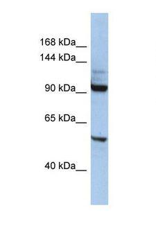 KIF19 Antibody - Western blot of Human HepG2. KIF19 antibody dilution 1.0 ug/ml.  This image was taken for the unconjugated form of this product. Other forms have not been tested.