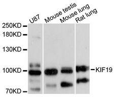 KIF19 Antibody - Western blot analysis of extracts of various cell lines, using KIF19 antibody at 1:3000 dilution. The secondary antibody used was an HRP Goat Anti-Rabbit IgG (H+L) at 1:10000 dilution. Lysates were loaded 25ug per lane and 3% nonfat dry milk in TBST was used for blocking. An ECL Kit was used for detection and the exposure time was 10s.