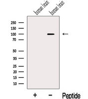 KIF19 Antibody - Western blot analysis of extracts of human brain tissue using KIF19 antibody. The lane on the left was treated with blocking peptide.