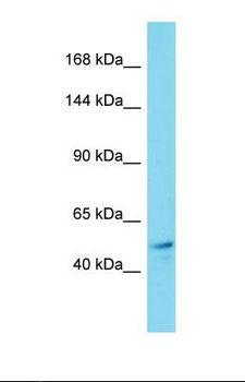 KIF19 Antibody - Western blot of Human Thyroid Tumor. KIF19 antibody dilution 1.0 ug/ml.  This image was taken for the unconjugated form of this product. Other forms have not been tested.
