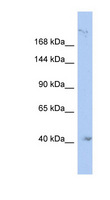 KIF1A Antibody - KIF1A antibody Western blot of THP-1 cell lysate. This image was taken for the unconjugated form of this product. Other forms have not been tested.