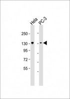 KIF1B / CMT2 Antibody - All lanes: Anti-KIF1B Antibody at 1:2000 dilution. Lane 1: HeLa whole cell lysate. Lane 2: PC-3 whole cell lysate Lysates/proteins at 20 ug per lane. Secondary Goat Anti-mouse IgG, (H+L), Peroxidase conjugated at 1:10000 dilution. Predicted band size: 130 kDa. Blocking/Dilution buffer: 5% NFDM/TBST.
