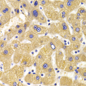 KIF1B / CMT2 Antibody - Immunohistochemistry of paraffin-embedded Human liver injury tissue.