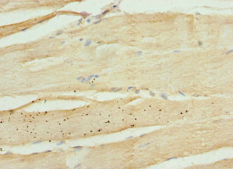KIF1B / CMT2 Antibody - Immunohistochemistry of paraffin-embedded human skeletal muscle tissue at dilution 1:100