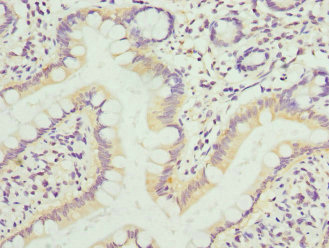 KIF1B / CMT2 Antibody - Immunohistochemistry of paraffin-embedded human small intestine at dilution 1:100