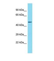 KIF1BP Antibody - Western blot of Mouse Thymus. Kbp antibody dilution 1.0 ug/ml.  This image was taken for the unconjugated form of this product. Other forms have not been tested.