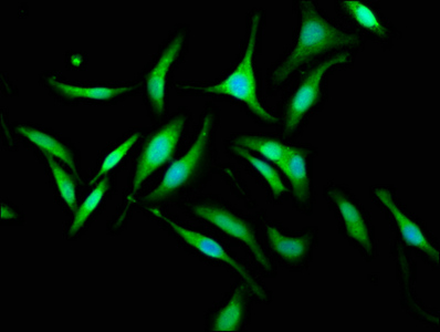 KIF1BP Antibody - Immunofluorescence staining of Hela cells at a dilution of 1:133, counter-stained with DAPI. The cells were fixed in 4% formaldehyde, permeabilized using 0.2% Triton X-100 and blocked in 10% normal Goat Serum. The cells were then incubated with the antibody overnight at 4 °C.The secondary antibody was Alexa Fluor 488-congugated AffiniPure Goat Anti-Rabbit IgG (H+L) .