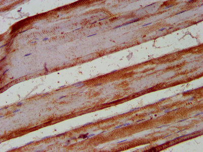 KIF1BP Antibody - Immunohistochemistry image at a dilution of 1:400 and staining in paraffin-embedded human skeletal muscle tissue performed on a Leica BondTM system. After dewaxing and hydration, antigen retrieval was mediated by high pressure in a citrate buffer (pH 6.0) . Section was blocked with 10% normal goat serum 30min at RT. Then primary antibody (1% BSA) was incubated at 4 °C overnight. The primary is detected by a biotinylated secondary antibody and visualized using an HRP conjugated SP system.