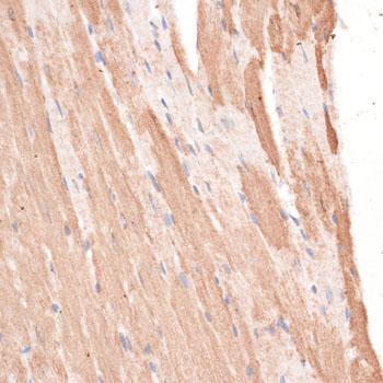 KIF1C Antibody - Immunohistochemistry of paraffin-embedded Mouse heart using KIF1C Polyclonal Antibody at dilution of 1:100 (40x lens).