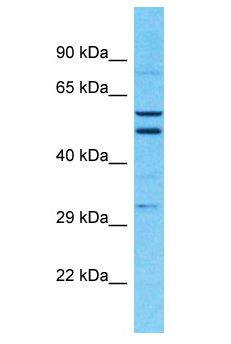 KIF20B Antibody - KIF20B antibody Western Blot of 721_B. Antibody dilution: 1 ug/ml.  This image was taken for the unconjugated form of this product. Other forms have not been tested.