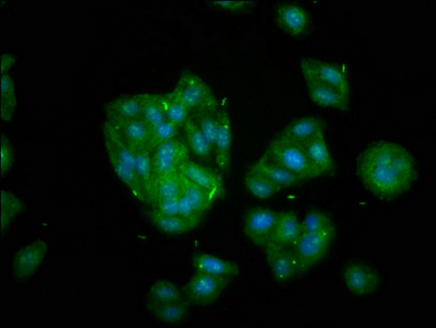 KIF20B Antibody - Immunofluorescence staining of HepG2 cells at a dilution of 1:133, counter-stained with DAPI. The cells were fixed in 4% formaldehyde, permeabilized using 0.2% Triton X-100 and blocked in 10% normal Goat Serum. The cells were then incubated with the antibody overnight at 4 °C.The secondary antibody was Alexa Fluor 488-congugated AffiniPure Goat Anti-Rabbit IgG (H+L) .
