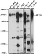 KIF20B Antibody - Western blot analysis of extracts of various cell lines, using KIF20B antibody at 1:1000 dilution. The secondary antibody used was an HRP Goat Anti-Rabbit IgG (H+L) at 1:10000 dilution. Lysates were loaded 25ug per lane and 3% nonfat dry milk in TBST was used for blocking. An ECL Kit was used for detection and the exposure time was 10s.