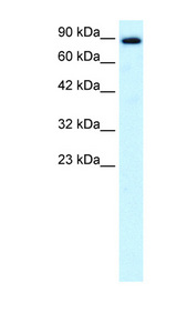KIF21A Antibody - KIF21A antibody Western blot of Fetal Brain lysate. This image was taken for the unconjugated form of this product. Other forms have not been tested.