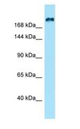 KIF21B Antibody - KIF21B antibody Western Blot of HeLa.  This image was taken for the unconjugated form of this product. Other forms have not been tested.