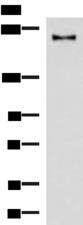 KIF21B Antibody - Western blot analysis of Mouse brain tissue lysate  using KIF21B Polyclonal Antibody at dilution of 1:1000